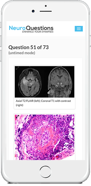 NeuroQuestions mobile view